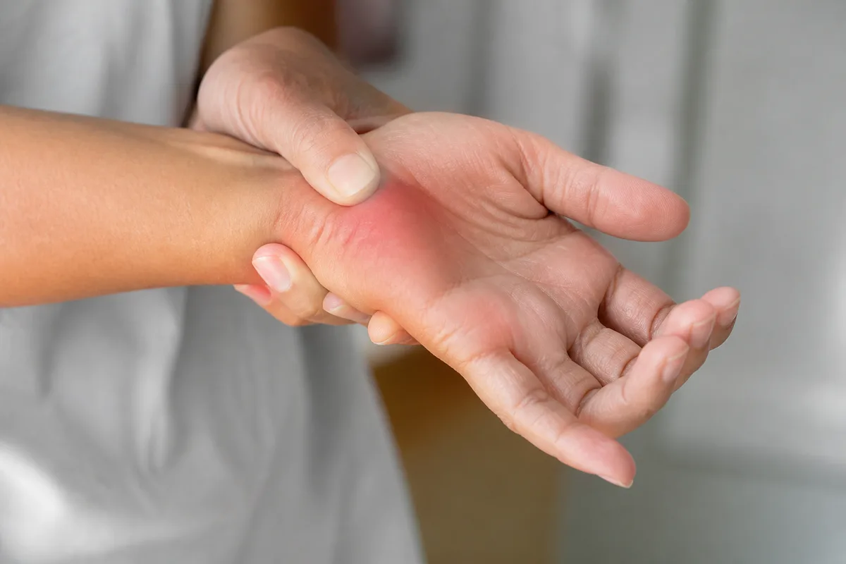 Carpal Tunnel Syndrome