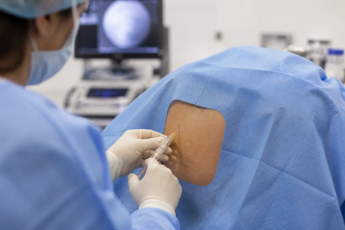 Epidural Injections